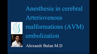 Anesthesia in cerebral embolization of Arteriovenous malformations (AVM)