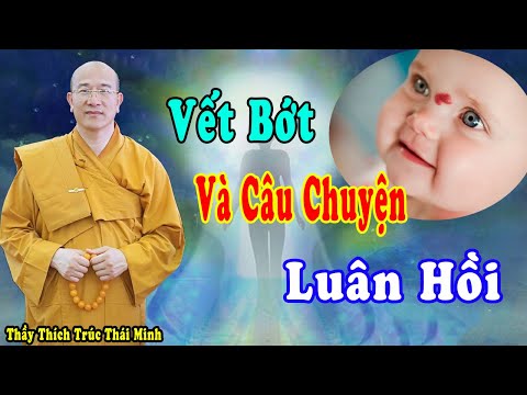 Video Vết Chàm, Vết Bớt Trên Cơ Thể Có Mối Liên Hệ Gì Với... - youtube