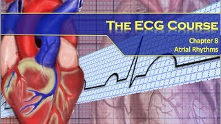 The ECG Course - Atrial Rhythms