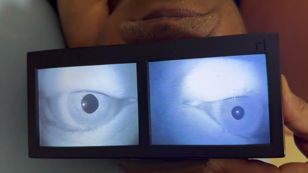 Head Yaw Test and Bow and Lean Test