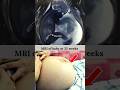 Baby At 32 Weeks MRI Share Pregnancy Augdailyshorts Fetus Baby At 32 Weeks MRI Share Pregnancy Augdailyshorts Fetus