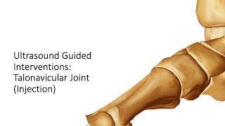 Ultrasound-Guided Talonavicular Joint Injection | Step-by-Step Sports Medicine Guide screenshot 4