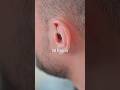 Smallest hearing aid Ai-powered with app control