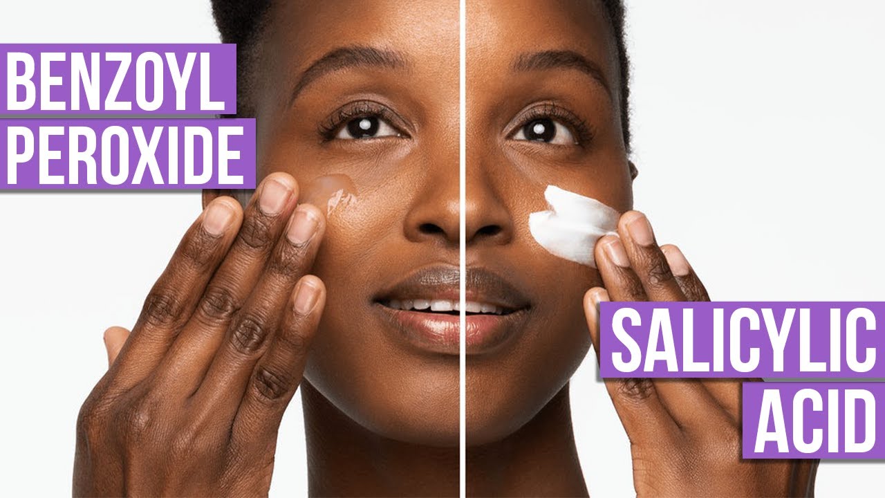 Salicylic Acid vs Benzoyl Peroxide Which is Best? YouTube