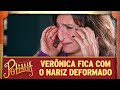 Verônica fica com o nariz deformado | As Aventuras de Poliana