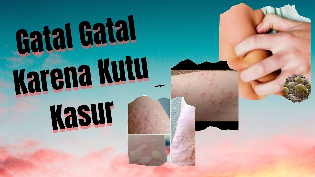 Gatal Gatal Karena Kutu Kasur 
