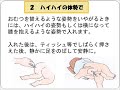 坐薬の使い方