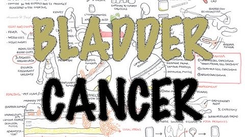 Bladder Cancer - Overview (types, pathophysiology, diagnosis, treatment)
