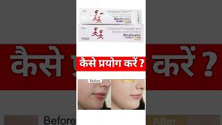 Medisalic Cream Review And Uses,Priceunique Pharmacy