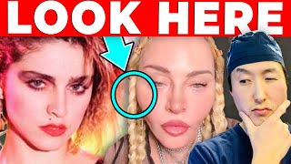 Plastic Surgeon Reacts to MADONNA’S Cosmetic Surgery Transformation!