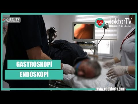 GASTROSKOPİ - ENDOSKOPİ (Gastroskopi Nasıl Yapılır ?)