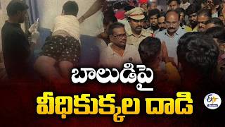 Street Dog Attack On 3-Year-Old at Bhuvanagiri District