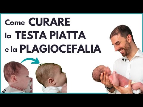 Video: La testa deforme si correggerà da sola?