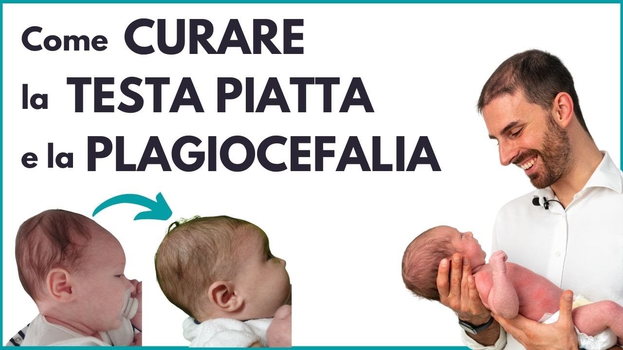 Come Curare la Testa Piatta e la Plagiocefalia posizionale del neonato  (Rimedi) 