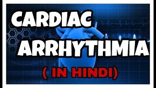 Cardiac Arrhythmia | Bradycardia v/s Tachycardia in hindi | Become Doctor