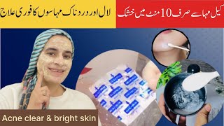 Disprin ye let’s for skin whitening & acne remover | Instant Pimple Dry Remedy |Husnology by iqra
