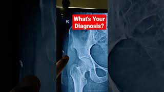 What's Your Diagnosis? Dr Sai Chandra MBBS DNB Ortho