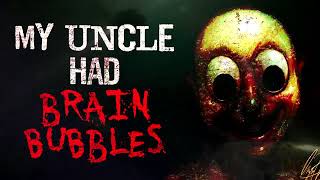 My uncle had brain bubbles