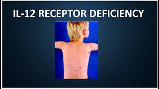 IL 12 receptor deficiency - Immunology USMLE Step 1