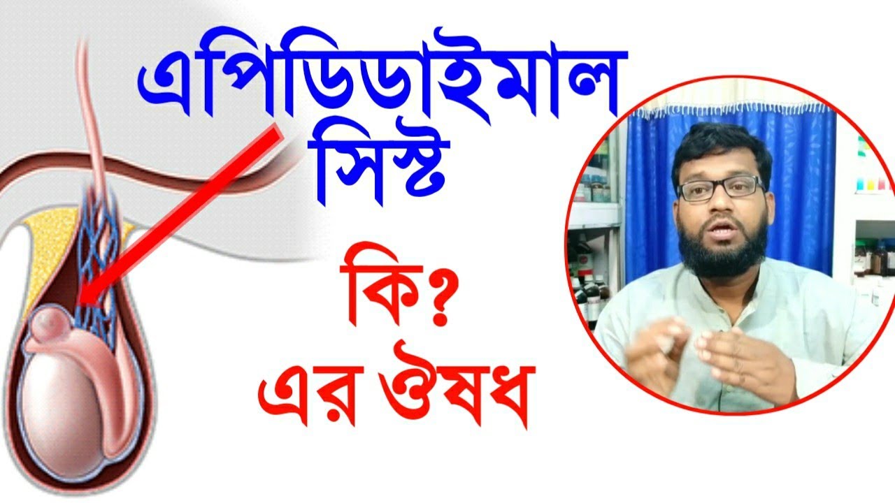 এপিডিডাইমাল সিস্টের বায়োকেমিক আর হোমিও ঔষধ | Epididymal cyst homeopathy medicine