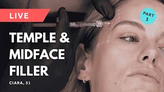 💎 Pre-Wedding Full Face Filler Case Study Part 1: LIVE Temple & Midface Filler (GEM© Clinic) 💎 Pre-Wedding Full Face Filler Case Study Part 1: LIVE Temple & Midface Filler (GEM© Clinic)