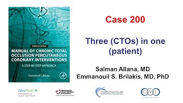 Case 200: Manual of CTO PCI - Three in one
