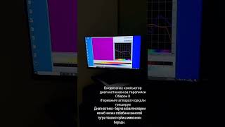 Biorezanas Kompyuter Diagnostikasi