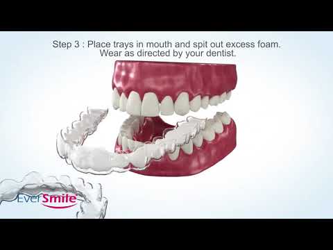 Wie Sie Ihre Aligner oder Retainer in 3 einfachen Schritten mit WhiteFoam von EverSmile reinigen