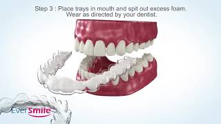 How To Clean Your Aligner Or Retainer In 3 Simple Steps With Whitefoam By Eversmile