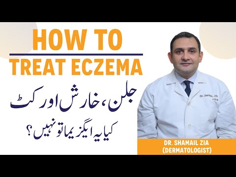 Why Womenβs Hands Get Dry After Washing? - Eczema Kya Hota Hai - Kharish Ka Asaan Ilaj thumbnail image
