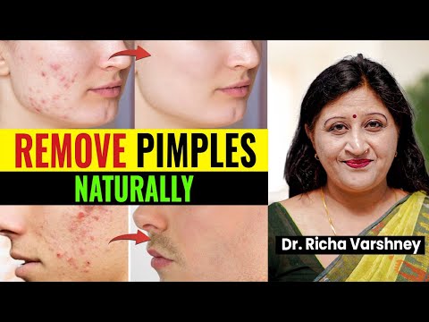 Pimples Treatment |