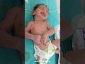 New born baby &amp; seizure #Not cry afterbirth