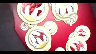 Kamillosan Philippines Sinks Tvc15S 060115