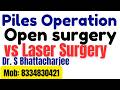 Piles surgery conventional | Open surgery for piles | piles ka operation