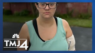Dog attack survivor opens up, shares update in long road to recovery