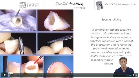 Preview The Provisional what are the differences between Vertical and Horizontal Protocols subtitled