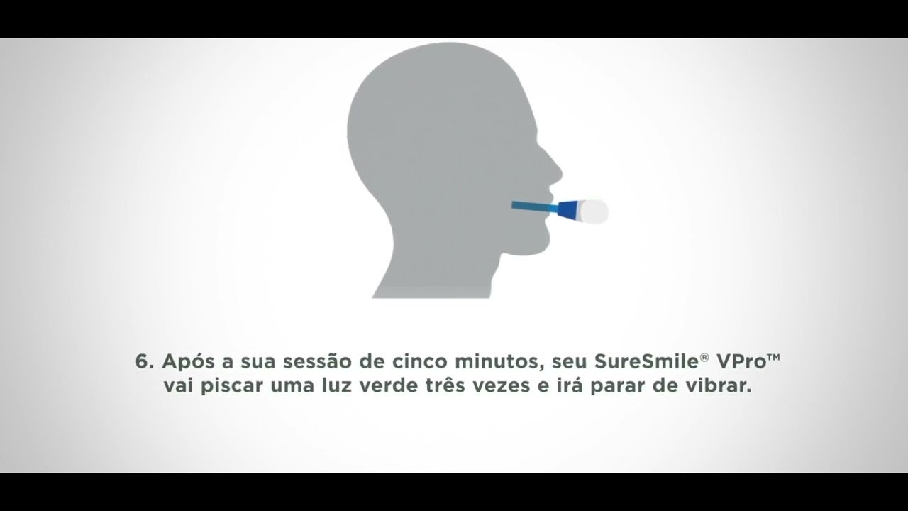 Primeiros Passos com VPro | SureSmile - YouTube