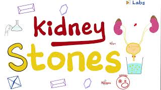 Urine Crystals & Kidney Stones