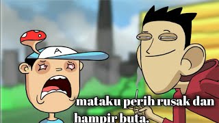 Mata acil bengkak karena sedih melihat teman temannya rusak karna rokok!!