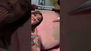 Did I hammer home that they are SMOOSHING the skin?! 🤣 Dr Pimple Popper Reacts