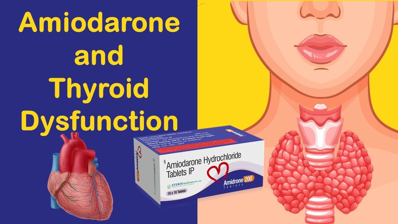Amiodarone (Cordarone) and Thyroid Dysfunction( Hypothyroidism - Hyperthyroidism)