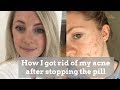 HOW I GOT RID OF ACNE AFTER STOPPING THE PILL