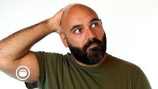 Why Going Bald Does Not Have To