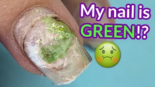 She Used Nail Glue And THIS is What Happened   | Melodysusie Efile Review