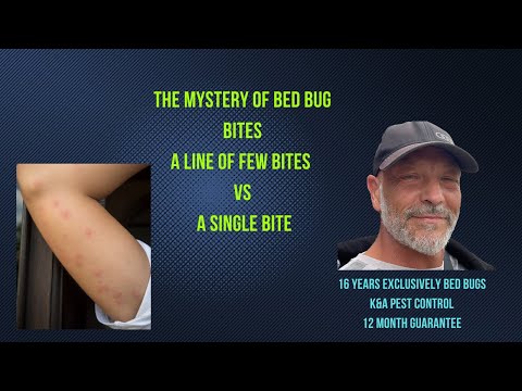 Finally! Bed Bug Bites Mystery Solved