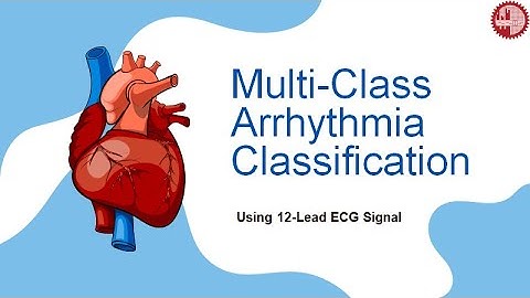 Multi-Class Arrhythmia Classification using 12-lead ECG Signals (CNN)
