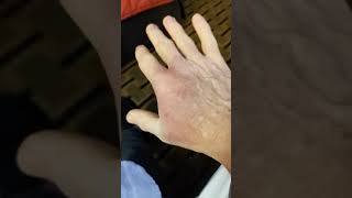 I hope its not broken
