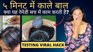 5 मिनट में काले बाल Testing Viral Hair Dye Hack | Instant Homemade Kalonji Hair Dye