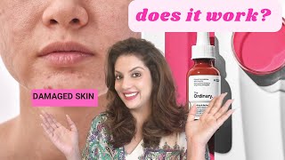 Ordinary Barrier Support Serum| Does it work? Review & Routine of the new ordinary serum