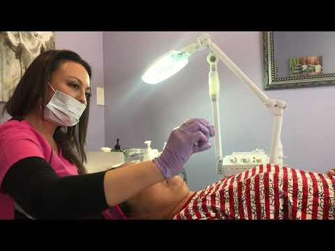This patient is getting a Cosmelan Peel